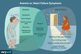 anemia and heart failure ociation