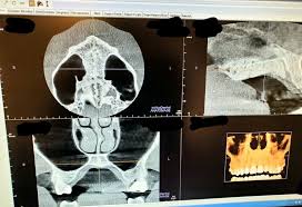 cone beam imaging dentist in appleton wi