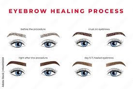 the eyebrow healing process after