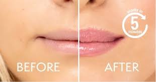 skin doctors instant lip plumper 3ml
