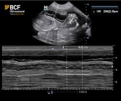 Using Ultrasound To Evaluate The Canine Pregnancy
