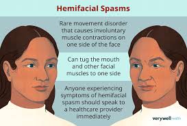 hemi spasm symptoms causes