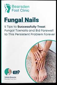fungal nails treatment clearanail