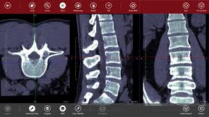 Dicom viewer provides high quality image processing optimally designed for computed radiography. Top 15 Free Dicom Viewers