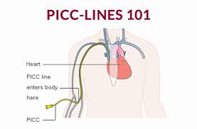 picc lines and ports cancer 101