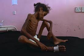 Image result for photos of Abrar in Yemen
