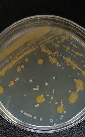 contamination on lb agar plate