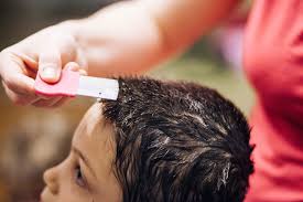 how to get rid of head lice and nits