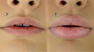 how to get big huge lips without