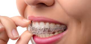 The process of braces can be painful but it one of the most efficient ways to get. Invisalign For Gaps Is It Right For You 209 Nyc Dental