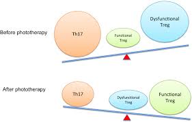Current Developments In Phototherapy For Psoriasis Morita 2018 The Journal Of Dermatology Wiley Online Library