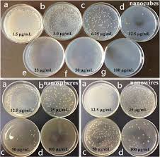 petri dishes with lb agar inoculated