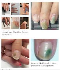 Maybe you would like to learn more about one of these? I Have Acrylics Nails One Nails Has Green Spot Under It What Should I Do About It Quora