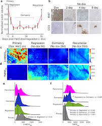 in vivo metabolic imaging identifies