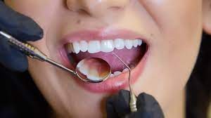 Dental Treatments - SmilePoint Dental