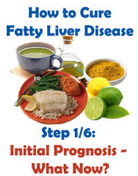 How To Cure Fatty Liver Disease Fatty Liver Diet Guide