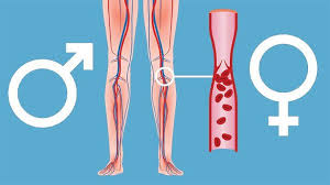 That blood clot can then block a blood vessel in your lungs. Search Highlights Gender Differences For Deep Vein Thrombosis Everyday Health