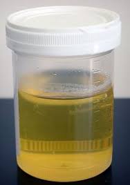 Whats The Normal Color Of Dog Urine Dog Discoveries
