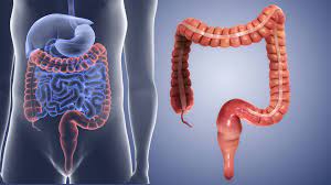 large intestine functions disorders