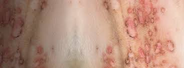 recognize autoimmune skin disease