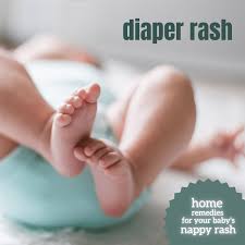 home remes for diaper rash nappy