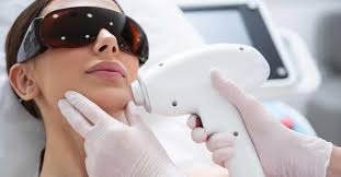 permanent laser hair removal for face
