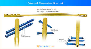 tibial tibia nail specification uses