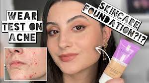sephora clean foundation on acne e
