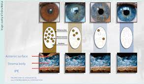 crstoday permanent iris color change