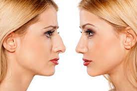 6 ways to make your nose smaller which