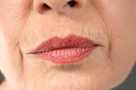 vertical lip lines create a smooth