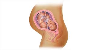 Twins Fetal Development 24 Weeks Pregnant Babycentre Uk