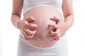 Image result for complication due to pregnancy