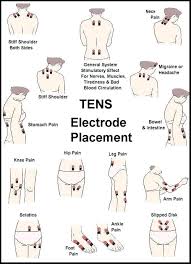 Tens Machine Electrodes Globalwebinars Co