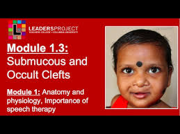 module 1 3 cleft palate sch and