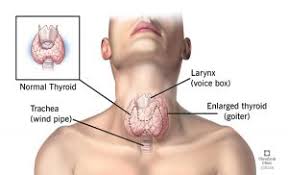 part two hypothyroidism and how it