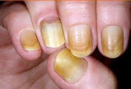 nails are the window to your health