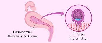 6 Effective Ways To Increase Endometrial Thickness Naturally