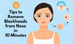 tips to remove blackheads from nose in