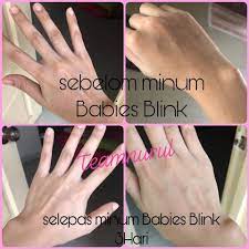 Pati ibu putih krim glutathione pati. Babies Blink Beauty Drink Johor Home Facebook