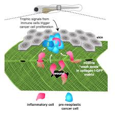 Basement Membrane Zone By Immune Cells