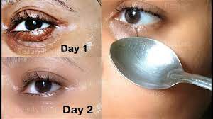 under eye wrinkles under eye bags
