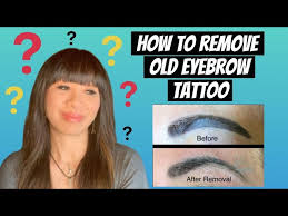 remove old and dark eyebrow tattoo