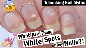 white spots on your nails what causes