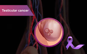 understanding testicular cancer curia app