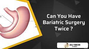 can you have bariatric surgery twice