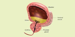 7 facts about prostate cancer what s