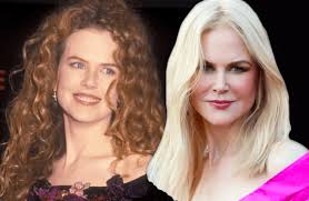 Nicole kidman has been serving revelations for three decades. Nicole Kidman Was Ist Bloss Mit Ihrem Gesicht Passiert