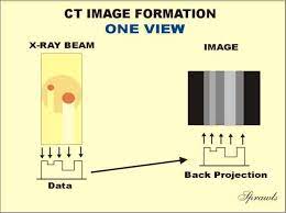 How is an x ray image formed. X Ray Image Formation And Contrast X Ray Images X Ray Contrast