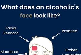 what does an alcoholics face look like